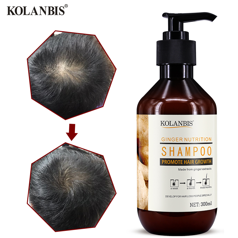 Китайский имбирный Шампунь против перхоти для роста волос травяной быстрой против выпадения волос продукты для контроля жирности