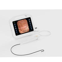 Uréteroscope vidéo flexible à usage unique, cystoscope médical, bronchoscope médical, urétéroscope flexible