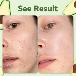 Masque facial au thé vert avec masque facial à l'<span class=keywords><strong>argile</strong></span> d'avocat pour l'acné Masque nettoyant hydratant pour le visage - Product Image 6