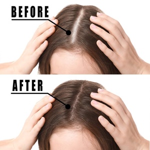 Olio di Argan Biologico OEM Naturale Vegano alle Erbe per Trattamento Capelli Uomo Donna - Siero e <span class=keywords><strong>Tonico</strong></span> per la Crescita dei Capelli - Product Image 4