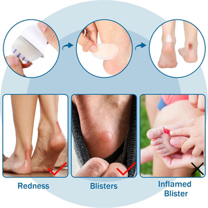 자체 접착 젤 힐 방지 프로텍터 신발 스티커 접착 패드 하이드로 콜로이드 물집 석고 패치 상처 드레싱 - Product Image 3