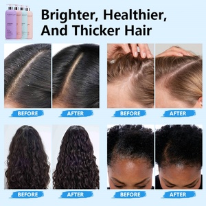 High Quality Organic Product Anti-dandruff Oil Control Fluffy <b>Shampoo</b> Silicone Free Fluffy <b>Shampoo</b> Daily-Use - Product Image 6
