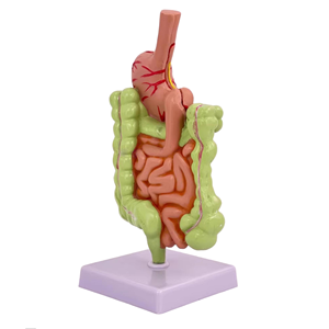 แบบจำลองการสอนทางการแพทย์ รุ่นลำไส้ใหญ่และโรคทางระบบทางเดินอาหาร - Product Image 5