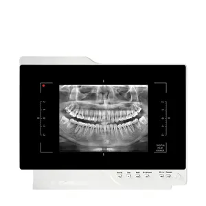 2 In 1 Instrument Leidde Medische X-Ray Filmviewer Of Negatoscoop Slanke Tandheelkundige Apparatuur Voor Één Paneel