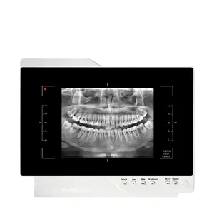 2 in 1 기기 LED 의료용 엑스레이 필름 뷰어 또는 네가토스코프 슬림 싱글 패널 치과 장비