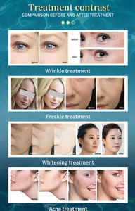 Appareil Facial Avancé pour l'Infusion de Sérum, Pulvérisateur d'Eau et d'Oxygène à 6 Buses Jet Peel, Professionnel pour Salon - Product Image 4