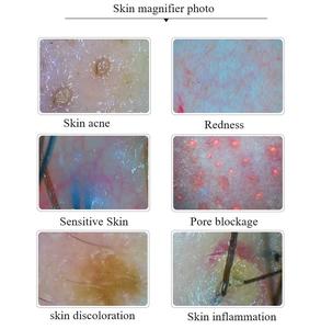 Sistema de pantalla de 10 pulgadas, máquina de análisis de cabello portátil que detecta la cámara del cuero cabelludo del salón, escáner de piel, equipo de belleza - Product Image 4