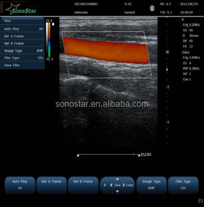 C10m 40 kênh siêu âm DOPPLER màu máy tính xách tay máy siêu âm - Product Image 3