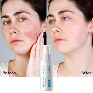 Spray Limpiador Facial Calmante Portátil con Ácido Hipocloroso Multiusos OEM para una Piel Más Tranquila, Spray de Alivio con Ácido Hipocloroso - Product Image 5