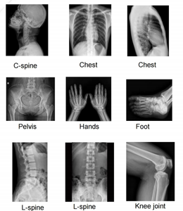Hochey 65KW DR Teto-mountedDigital Radiografia Sistema Avançado Radiografia <span class=keywords><strong>Digital</strong></span> Hospital X Ray máquina - Product Image 6