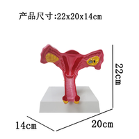 Modèles anatomiques grandeur nature de l'organisme vaginal et ovarien féminin et modèles anatomiques pathologiques de l'utérus pour l'enseignement médical CE/ISO