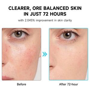 JMFREE韓国プライベートラベルPDRNヒアルロン酸カプセル100血清皮膚修復抗酸化抗しわスキンケアフェイシャルセラム - Product Image 5