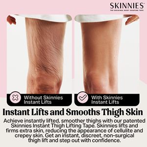 Cinta Adhesiva Transparente de PU para Mujer - Reduce la Fricción de las Musletas, Levanta y Sostiene Piernas y Brazos con Piel Flácida en el Abdomen, Certificación CE - Product Image 2