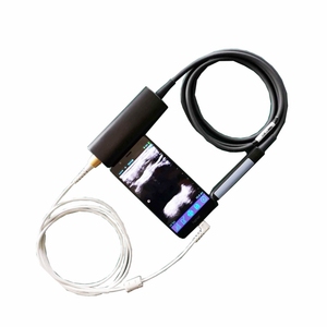 Alat Pemindai USG Rektal USB Tipe B untuk Laptop dan Tablet - Product Image 3