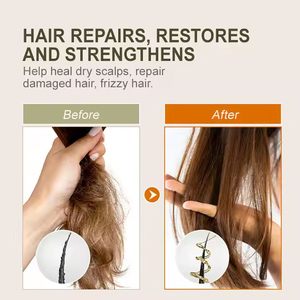 Cosméticos orgánicos naturales Babys <span class=keywords><strong>mejor</strong></span> aceite <span class=keywords><strong>para</strong></span> <span class=keywords><strong>el</strong></span> cabello nutritivo hidratante suave Romero Chebe Oliva jengibre aceite <span class=keywords><strong>para</strong></span> <span class=keywords><strong>el</strong></span> cuidado del cabello - Product Image 3