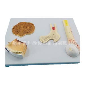 Modèle de structure osseuse : os épongeux, os compact, os Haver, cartilage périostal, modèle pédagogique orthopédique humain. - Product Image 4