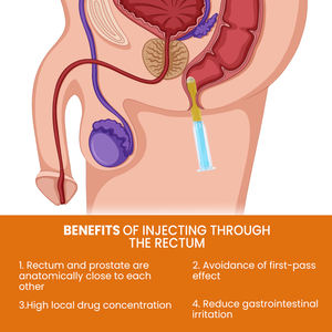 Prostata-Kräutergel Zur Linderung Von Prostatabeschwerden, Yang-Pflege für Männer, Gesundheitspflege, Körperpflege - Product Image 3