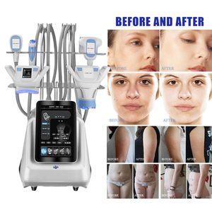 Máquina de Masaje Corporal con Rodillos, Máquina de Masaje Corporal para Reafirmar la Piel, Máquina de Drenaje Linfático para Salón o Hogar - Product Image 6