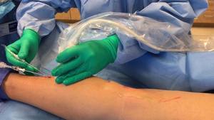 Perawatan Varises dengan Laser TRIANGEL 980nm EVLT Fiber Laser Mesin Laser 1470nm - Product Image 5