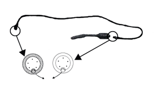 Équipement de traitement ambulatoire sans anesthésie-Dispositif de traitement de la <span class=keywords><strong>prostate</strong></span> - Product Image 5