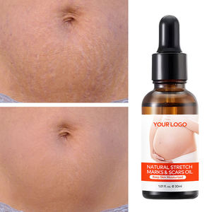 Huile naturelle GREENLEM pour les vergetures et les cicatrices, huile réparatrice pour la peau, à utiliser sur le corps, efficace pour les vergetures et l'élimination des cicatrices, huile pour le ventre plat - Product Image 4