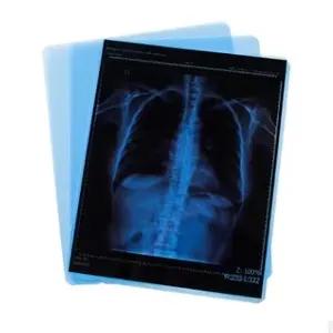 Haustier-X-Ray-Medizinfilm Schlussverkauf medizinische X-Ray-Thermofolie Ct-Scan 14 x 17 Zoll x-Ray-Film für Agfa Drystar 5302