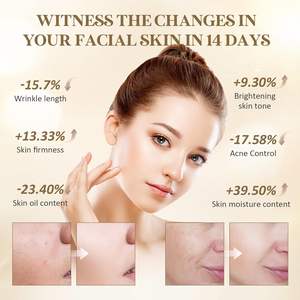 Masque facial LED de luminothérapie rouge et bleue, traitement <span class=keywords><strong>anti</strong></span>-âge et <span class=keywords><strong>anti</strong></span>-acné, <span class=keywords><strong>appareil</strong></span> de soin de la peau, masque de beauté pour la maison et le salon, pour les <span class=keywords><strong>rides</strong></span> et les rougeurs - Product Image 5