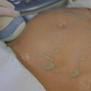 하이 퀄리티 도매 공장 가격 전문 의료 초음파 젤 초음파 전도성 젤 과 CE MSDS - Product Image 2