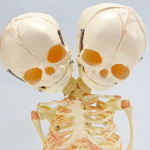 Foetale Twee Koppige Misvorming Model Schedel Medische Wetenschap Baby Skeletmodel Leert Menselijk Botmodel Abnormaal - Product Image 3