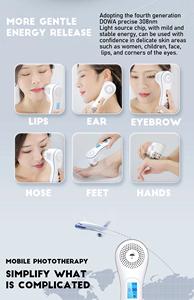 Fototerapi UV Portabel 308nm Laser Excimer untuk Pengobatan <span class=keywords><strong>Vitiligo</strong></span> <span class=keywords><strong>Psoriasis</strong></span> - Product Image 4