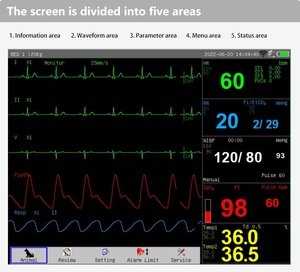 Ветеринарный монитор пациента: Интеллектуальная система ветеринарного мониторинга с экраном высокого разрешения, анализом тенденций и функцией мониторинга нескольких пациентов - Product Image 3