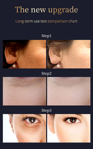 Dispositivo para el Cuidado Facial, Rellena Arrugas, Elimina Cicatrices, Mejora Manchas de Color y Marcas de Acné, Deja la <span class=keywords><strong>Piel</strong></span> Lisa y Suave - Product Image 4