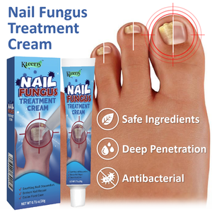 OEM Onychomykose-Behandlung Fußcreme Pilzentfernungscreme Anti-Infektions-Nagelpilz-Reparatur Chinesische Salbe - Product Image 2
