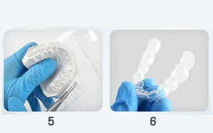 Orto allineatore Kit stecca da laboratorio foglio per Coping dentale TPU sottovuoto ex fogli per termoforme dentali - Product Image 5