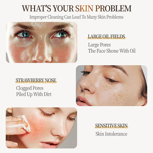 Limpiador Facial Espumoso OEM/ODM Nuevo de 150 ml, Mousse Facial <span class=keywords><strong>para</strong></span> el Acné, Limpiador Facial Hidratante, Jabón Líquido No Irritante - Product Image 4
