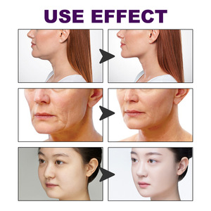 Patch de lifting facial invisible pour le menton, élastique, imperméable, en forme de V, pour un lifting rapide du menton, invisible, double menton - Product Image 6