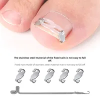 Onyx Nail Correctors Kit de correction des ongles incarnés Rouleaux à ongles Patches pour ongles Kit de correction des ongles incarnés