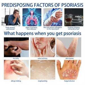 Мазь от псориаза «Южная Луна», 20 г - Product Image 5