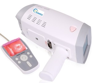 Draagbare Handheld Video Colposcoop DVC-9800B Inspectie Voor Vrouwelijke Gynaecologie <span class=keywords><strong>Vagina</strong></span> Onderzoek - Product Image 1