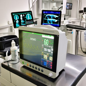 Monitor Veterinario de ECG Portátil Multiparamétrico para Mascotas, Monitor de Signos Vitales, SpO2, NIBP, Resp, Temp para Uso en Clínicas Veterinarias, Certificado CE - Product Image 3