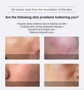 99% Spicule Peel Sérum Algues Éponge <span class=keywords><strong>Microneedling</strong></span> pour le traitement de l'acné Acide hyaluronique Bio Visage pour le nez Forme liquide - Product Image 3