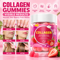 Gummies de collagène personnalisées avec vitamine C pour la peau, les cheveux, les ongles et le soutien des articulations – Complément alimentaire