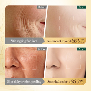 <span class=keywords><strong>Crema</strong></span> Facial de Miel de Manuka con Vitamina E, Producto <span class=keywords><strong>Hidratante</strong></span> y Nutritivo para el Cuidado de la <span class=keywords><strong>Piel</strong></span> - Product Image 3
