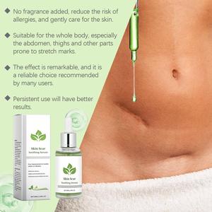 Suero Calmante para Cicatrices 50ml, Marca Privada OEM, Vitamina E, Aloe, Centella, Reduce Marcas de Quemaduras, Estrías, Vegano - Product Image 5