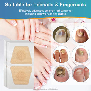 Tempelan korektor kuku jari kaki, pita perawatan kuku jari kaki profesional untuk menghilangkan rasa sakit dan koreksi - Product Image 5
