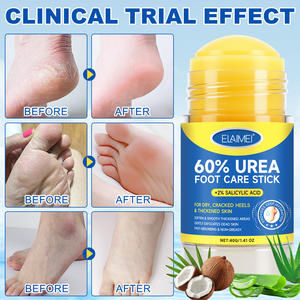 ELAIMEI 60% Urea <span class=keywords><strong>Foot</strong></span> Care Stick untuk Lutut, Siku, dan Kaki, Eksfoliasi Kulit Mati, Hidrasi Mendalam, Urea <span class=keywords><strong>Foot</strong></span> Stick untuk Tumit Kering dan Pecah-pecah - Product Image 2