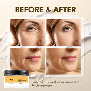 Crème hydratante pour le visage à la mucine d'escargot 92% Hydratante Anti-âge Raffermissante Réduction des rides pour tous les types de peau - Product Image 2