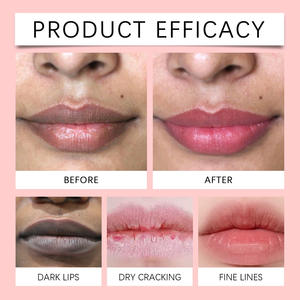 OUHOE ครีมบำรุงริมฝีปากสีชมพู ขจัดเซลล์ผิวที่ตายแล้ว ป้องกันริมฝีปากแตก บำรุงริมฝีปากให้อวบอิ่ม ลดรอยดำ ฟื้นฟูริมฝีปากให้กลับมาสีชมพู ชุ่มชื้นอย่างล้ำลึก - Product Image 5