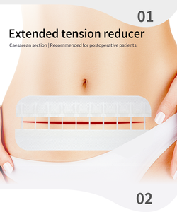 Vendajes para cierre de heridas, tiras de cierre de heridas, alternativa a los puntos para pequeños cortes y laceraciones - Product Image 4