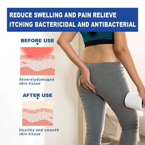 Ungüento Huainanhall <span class=keywords><strong>para</strong></span> <span class=keywords><strong>Hemorroides</strong></span>, Alivia Rápidamente y Naturalmente la Picazón, el Ardor y las Molestias de las <span class=keywords><strong>Hemorroides</strong></span>. - Product Image 6